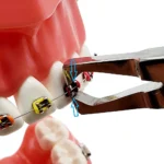 Orthodontic Bracket Removing Pliers - Image 5